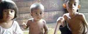 Bayi Kurang Gizi Itu Akhirnya Dirawat di RSUD Kayuagung item-thumbnail