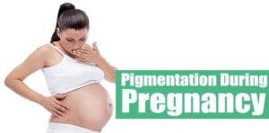 Hiperpigmentasi Pada Masa Hamil item-thumbnail